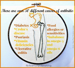 50 kinds of arthritis