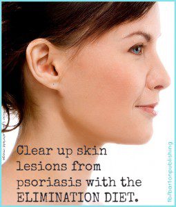 clear up psoriasis with elimination diet