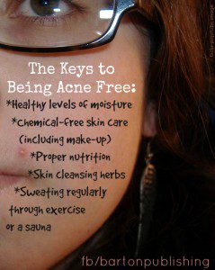 keys to being acne free