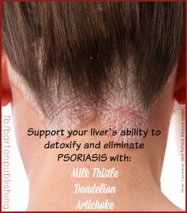 support your liver to detox and eliminate psoriasis