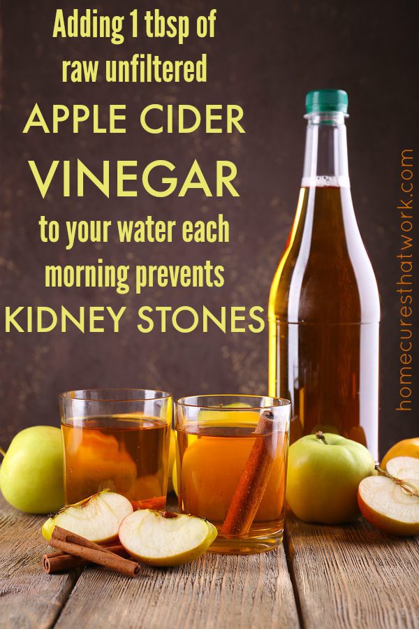 Naturally Preventing and Dissolving Kidney Stones - Home Cures That Work