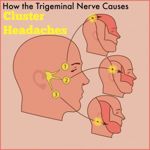 how trigeminal nerve causes cluster headaches