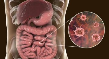 5 Common Foods That Can Harbor Parasites (And How to Protect Your Family)