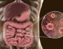 5 Common Foods That Can Harbor Parasites (And How to Protect Your Family)