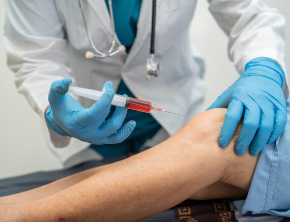 Prolotherapy: Avoiding Joint Replacement