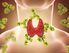 Illustration of thyroid and antibodies for hashimotos