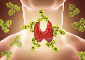Illustration of thyroid and antibodies for hashimotos