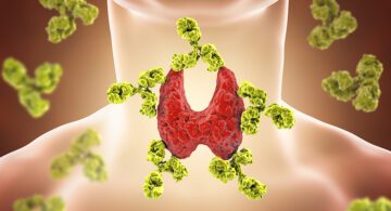 Illustration of thyroid and antibodies for hashimotos