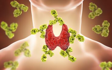 Hashimoto’s: Why Your Immune System Is Attacking Your Thyroid 1 Illustration of thyroid and antibodies for hashimotos