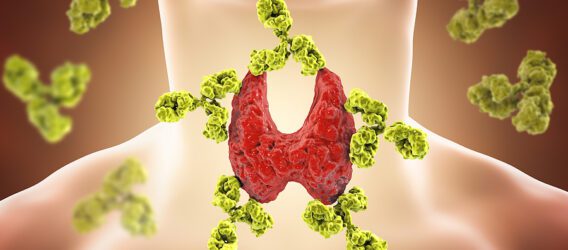  The Insulin-Thyroid Loop: Why Your Blood Sugar Might Be Running Your Thyroid